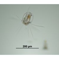 Polyarthra dolichoptera