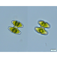 Staurastrum striolatum