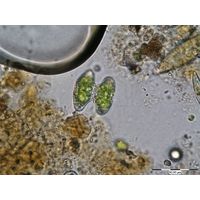 Staurastrum striolatum