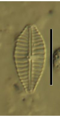 Gomphonema parvulum