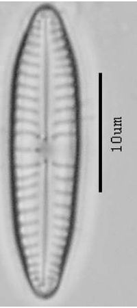 Gompohonema angustatum