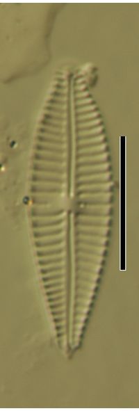 Gomphonema parvulum