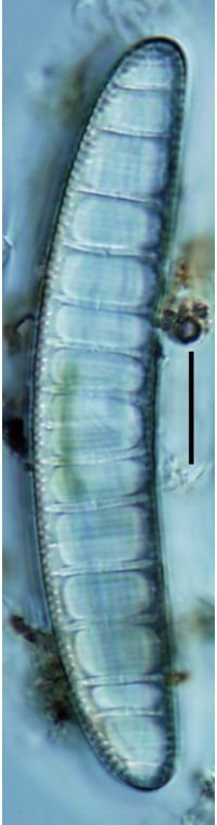 Epithemia adnata