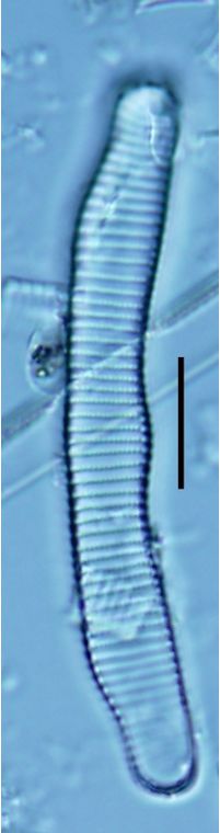 Eunotia pectinalis