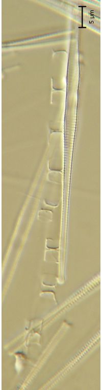Skeletonema potamos