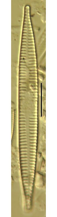 Synedra ulna