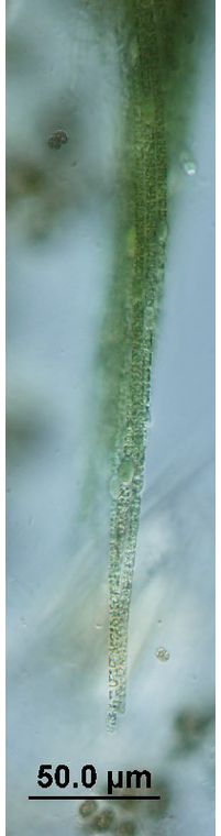 Aphanizomenon 