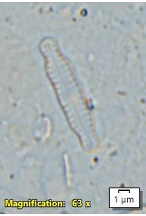 Chamaepinnularia soehrensis
