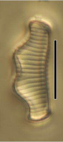 Eunotia bigibba