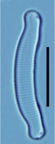 Eunotia exigua