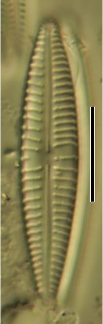 Gomphonema parvulum