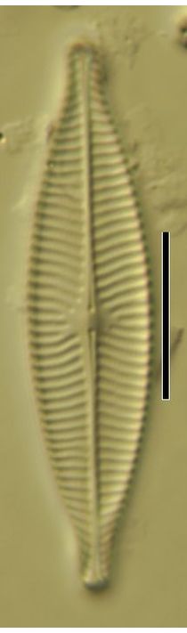 Navicula capitatoradiata