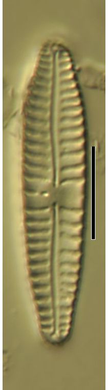 Gomphonema angustatum