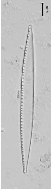 Nitzschia intermedia