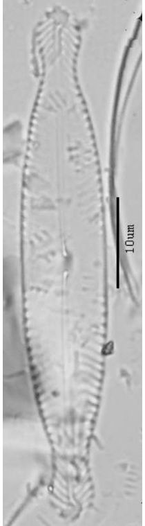 Pinnularia braunii