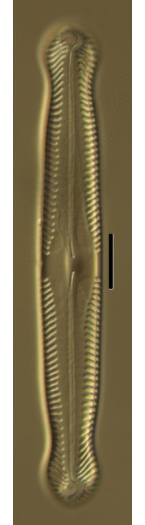 Pinnularia gibba