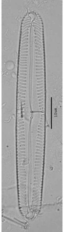 Pinnularia subgibba