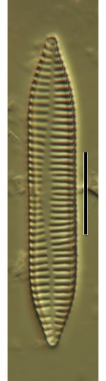 Synedra ulna