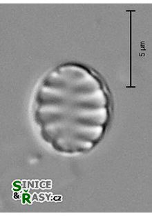 Staurosirella pinnata