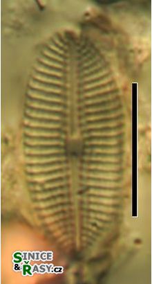 Diploneis