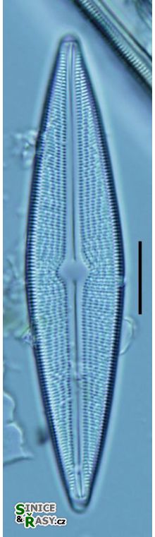 Brachysira serians