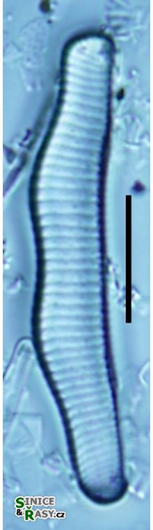 Eunotia circumborealis