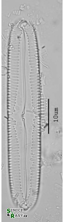 Pinnularia lokana