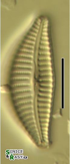 Cymbella excisa