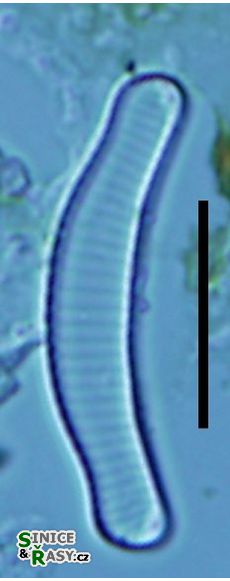Eunotia exigua