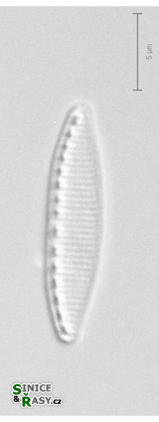 Nitzschia frustulum