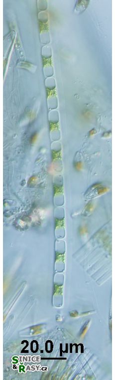 cf. Microspora stagnorum