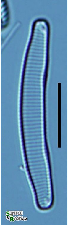 Eunotia tenella