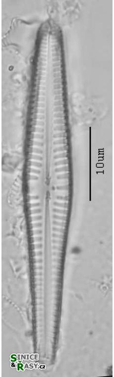 Gompohonema angustum