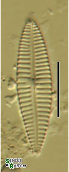 Gomphonema