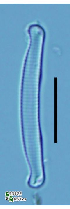 Eunotia nymanniana