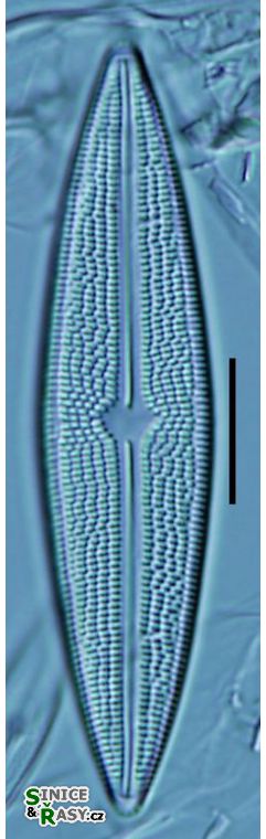 Brachysira serians
