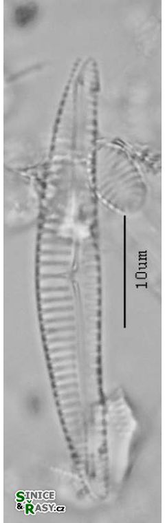 Encyonema