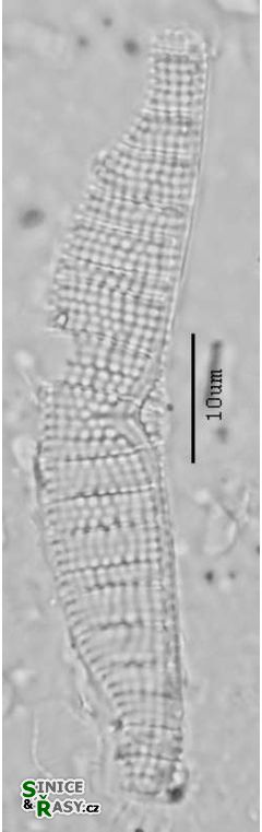 Epithemia adnata