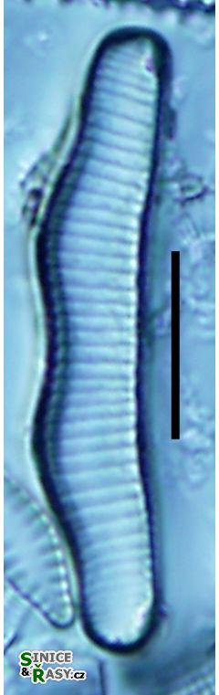 Eunotia circumborealis