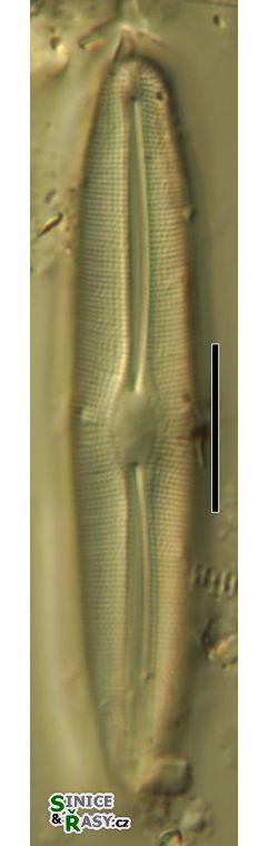Frustulia vulgaris