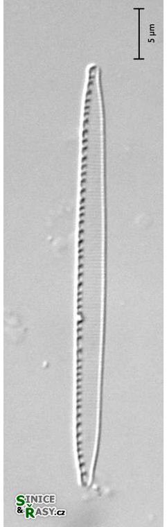 Nitzschia fruticosa
