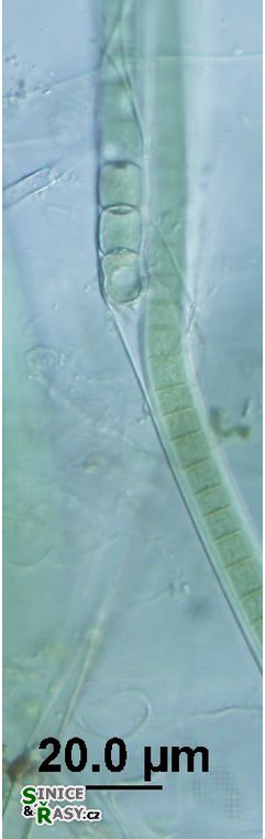 Tolypothrix tenuis