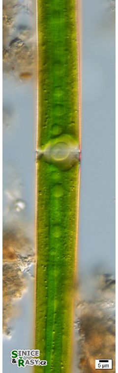 Closterium lineatum var. elongatum