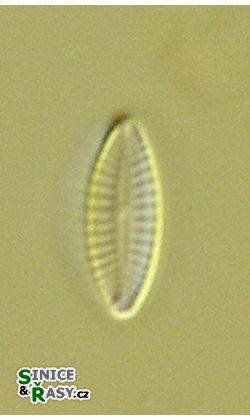 Achnanthidium subatomus
