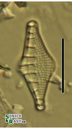 Nitzschia sinuata