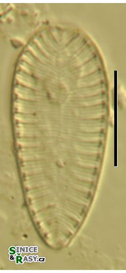 Surirella brebissoni