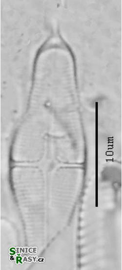 Stauroneis smithii