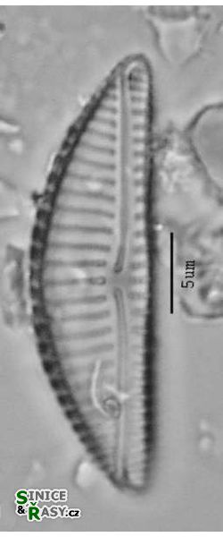 Encyonema silesiacum