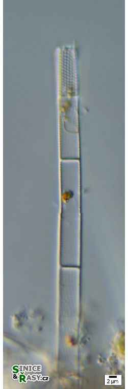 Aulacoseira sp. 