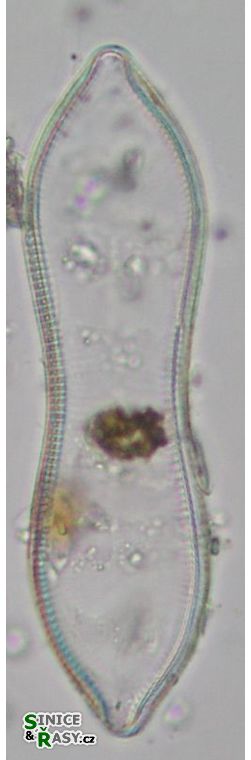 Cymatopleura solea
